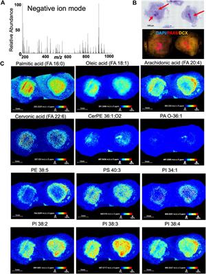 Mass spectrometry imaging as an emerging tool for studying metabolism in human brain organoids
